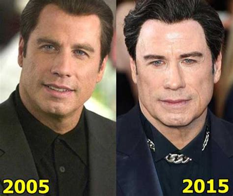 john travolta face lift|John Travoltas Plastic Surgery (Botox and Facelift)